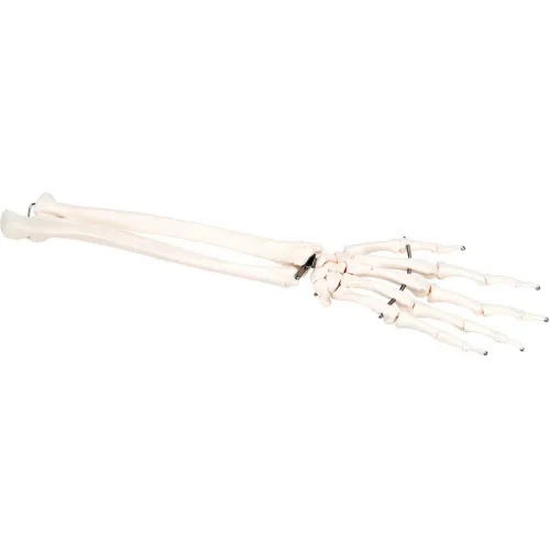3B® Anatomical Model - Loose Bones, Hand Skeleton with Ulna and Radius, Left